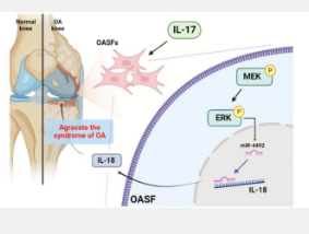 IL17通过促进骨关节炎滑膜成纤维细胞产生IL18